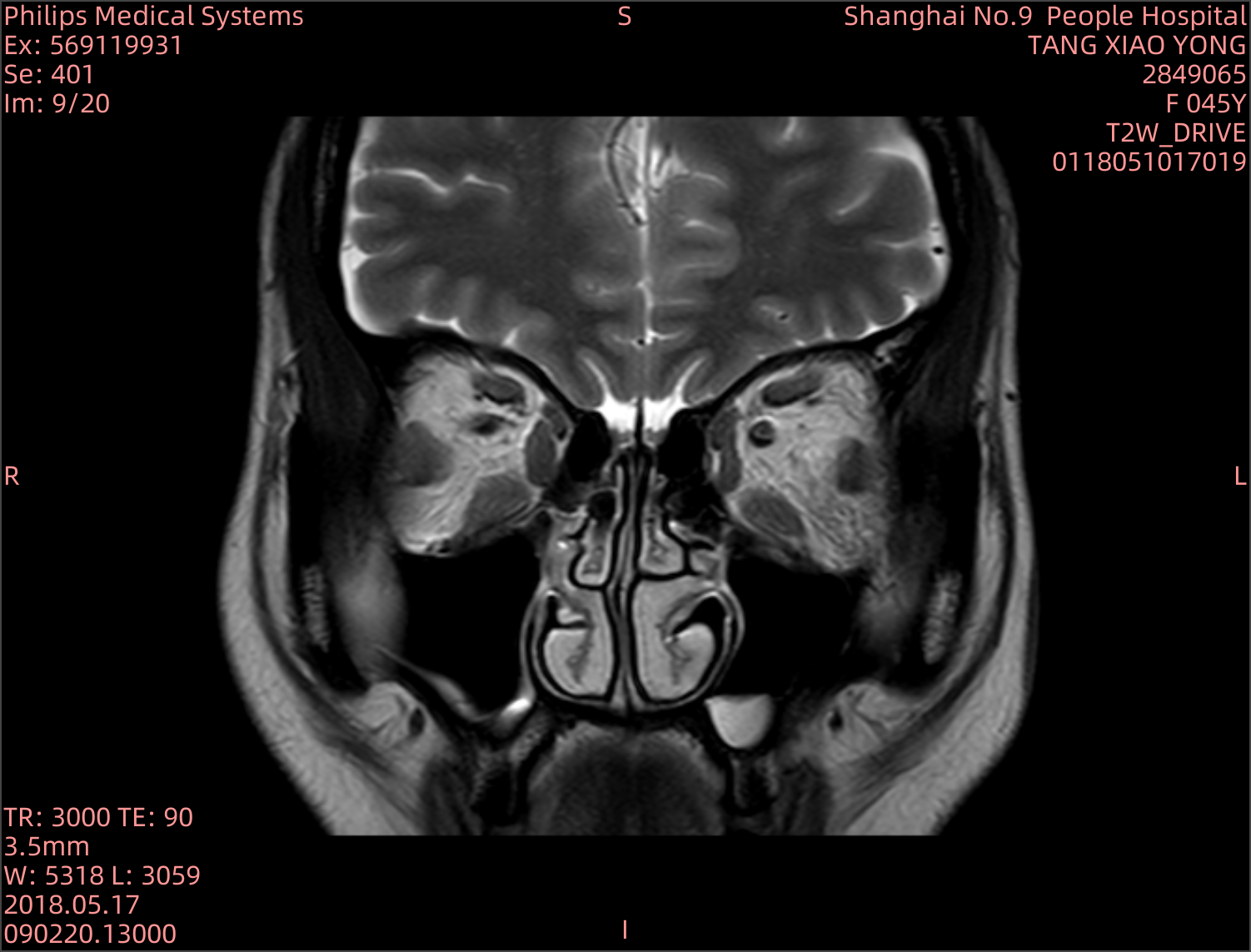 IMG-233401-0009-5ec8a1a1d60dbb76384b8b31f5de4fef