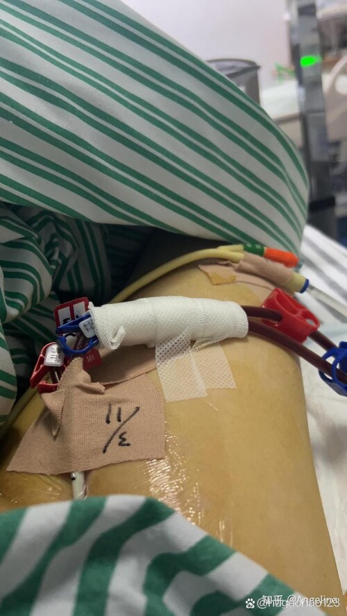 u=1131617433,2781737732&fm=253&fmt=auto&app=120&f=JPEG