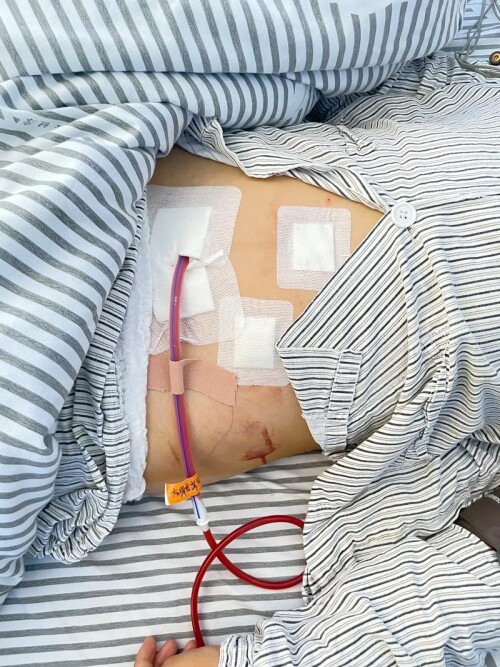 u=2901619808,2409143204&fm=253&fmt=auto&app=138&f=JPEG