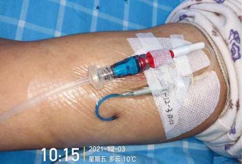 u=124372179,3855985033&fm=253&fmt=auto&app=138&f=JPEG