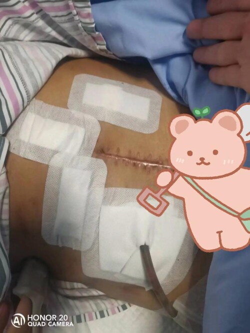 u=1279305002,262041559&fm=253&app=138&f=JPEG