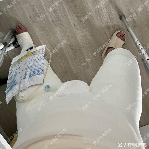 dbb44aed2e738bd41439a301e78b87d6277ff9e2