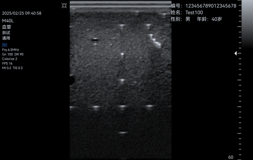 B-3d305a4ece68a3e56dc7951a2d715f2f.png