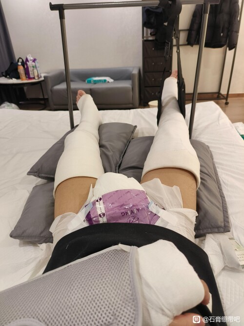 dfe45d3e6709c93df42986ebd93df8dcd30054c2