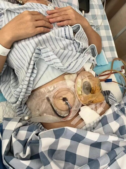 u=2929210565,1611425354&fm=253&fmt=auto&app=138&f=JPEG