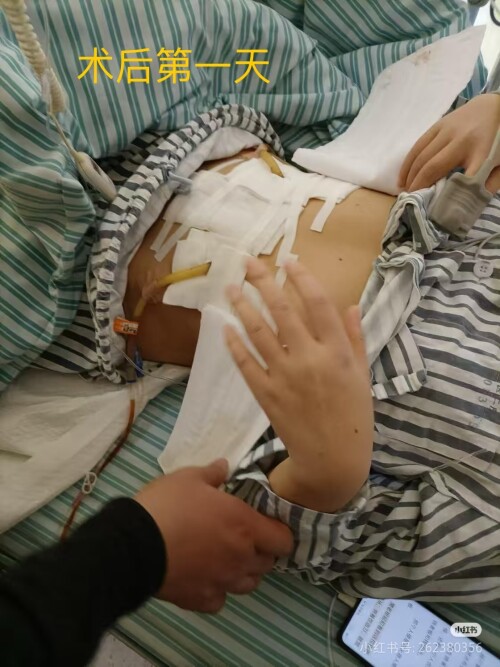 2025 08 16 18 50 20 324